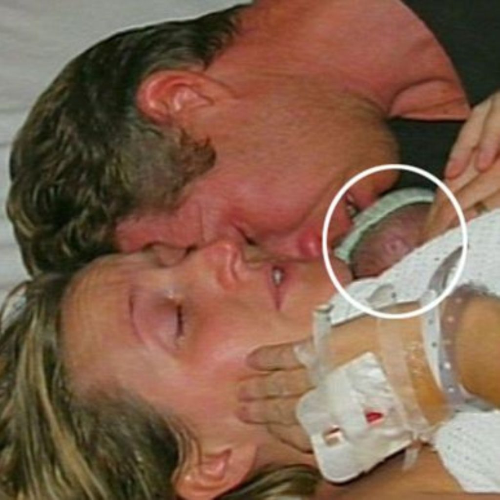 Doctors Told Her Her Premature Baby Was Gone. Two Hours Later, Something Changed
