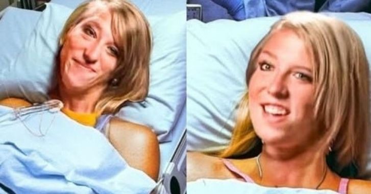 From Classroom to Marriage: The Unstoppable Journey of The Hensel Conjoined Twins