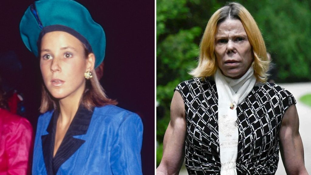 The Shocking Before-and-After Photos Everyone Is Talking About