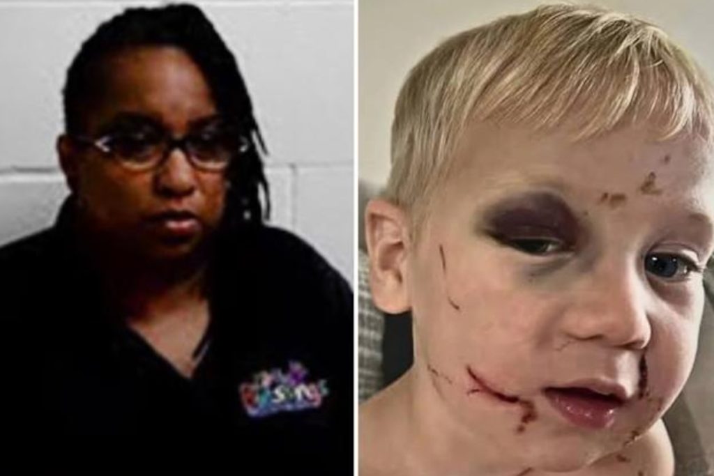 Black Eye and Swollen Face: Toddler’s First Day at Georgia Church Daycare Ends in Arrest