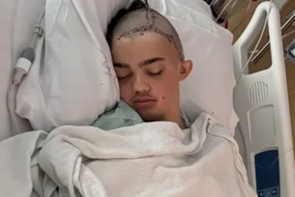 Schoolyard Attack Over Joke Ends With Student’s Head Held by 60 Staples