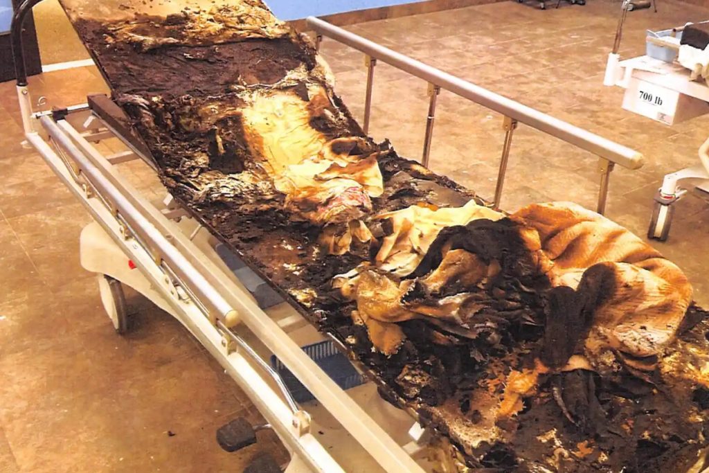 Boy Killed in Hyperbaric Chamber Explosion, Family Sues for $100M