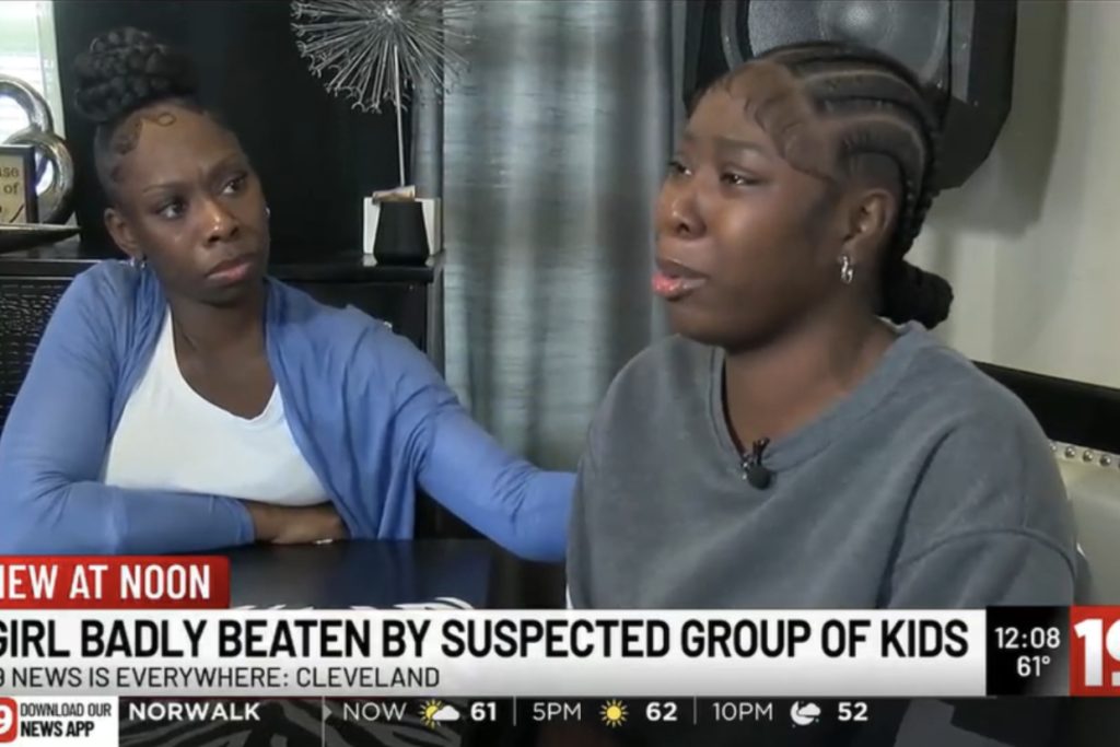 5-year-old left ‘unrecognizable’ after brutal attack — 2 Ohio kids charged