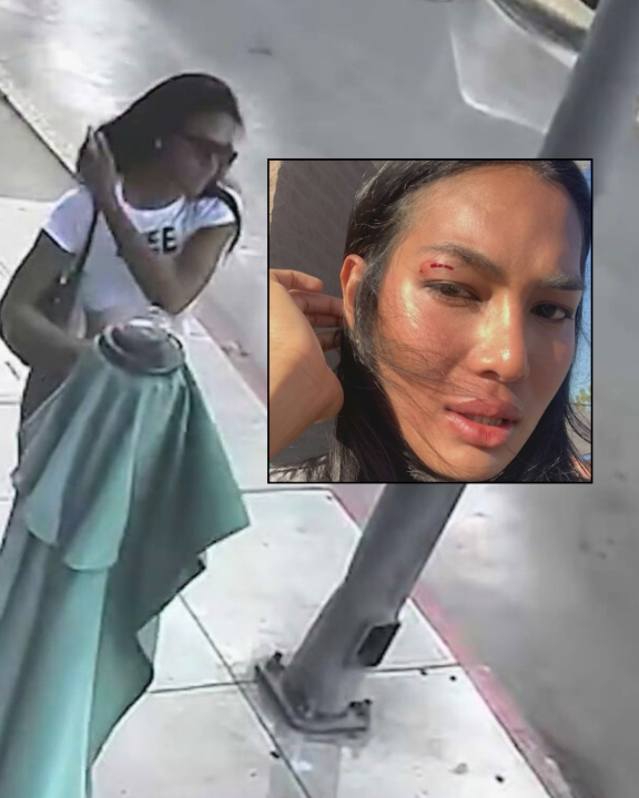 Hollywood model injured in unprovoked assault on Sunset Boulevard