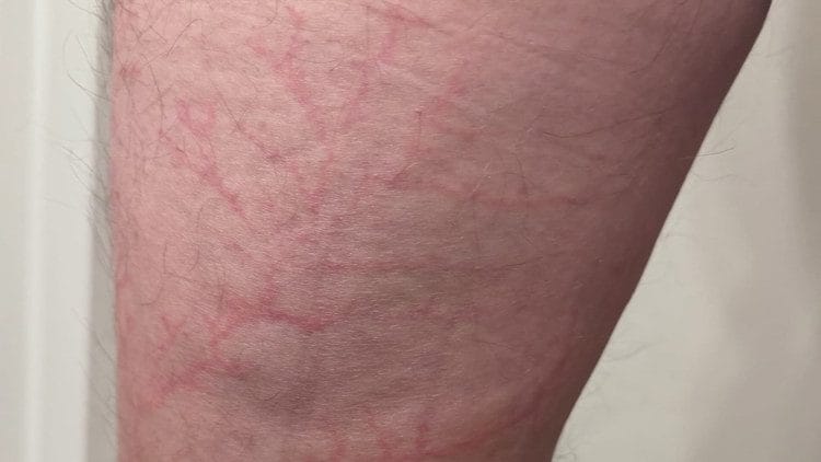 I was 110% in survival mode’: Hikers battle brutal weather to be rescued after being struck by lightning on Arizona mountain