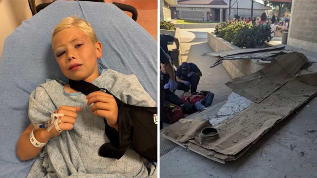 8-year-old boy suffers concussion, broken bone after part of ceiling collapses at California school