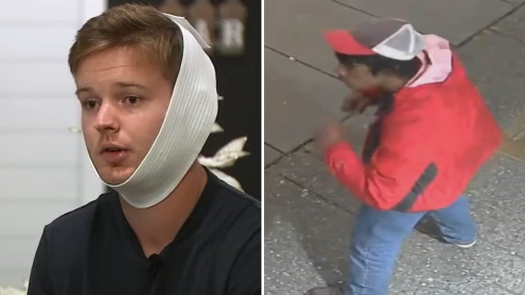 Man speaks out after random Center City assault leaves him with broken jaw