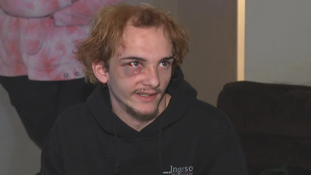 Teen accuses Webster police of using excessive force in arrest caught on video: “My teeth are broken”