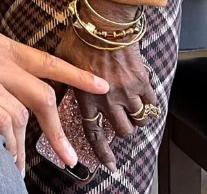 Family wants justice after robber bites off elderly woman’s finger