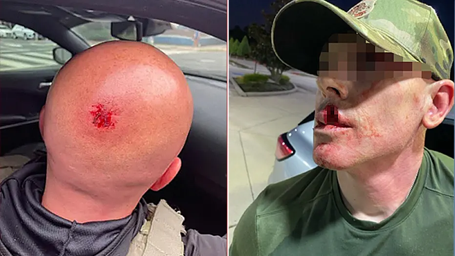 Sanctuary politicians’ rhetoric led to 1,150% surge in violence against ICE agents: DHS