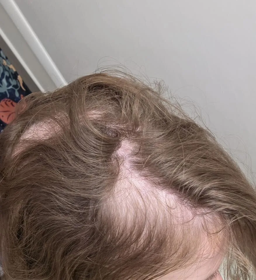 Ohio paramedic attacked while trying to help someone