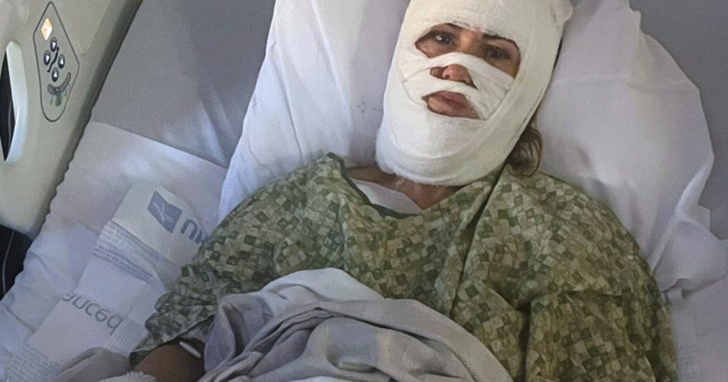 A Georgia woman suffers severe burns in a chemical attack at a Savannah park