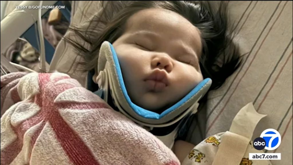 Man arrested in hit-and-run crash that injured baby, toddler in San Bernardino