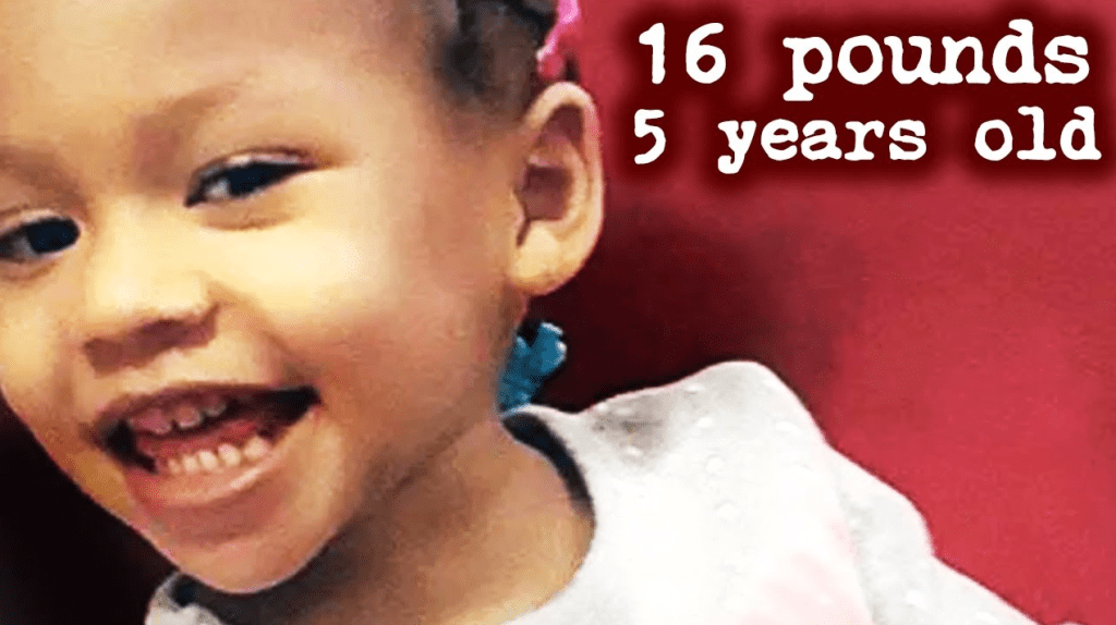 16 Pounds At 5 Years Old: The Sickening Case of Cali Anderson