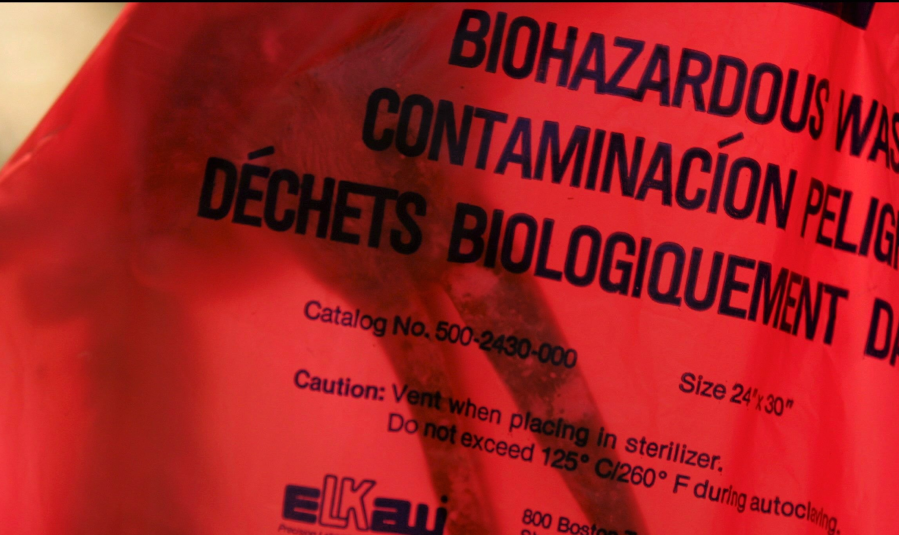 San Jose mortuary accused of mistakenly giving parent his son’s brain in bag