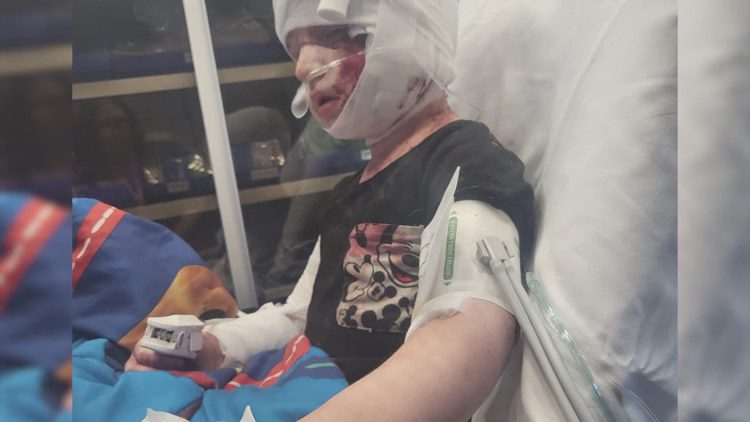 Complete shock’: Mom recounts dog attack where 4-year-old son’s ear was ripped off