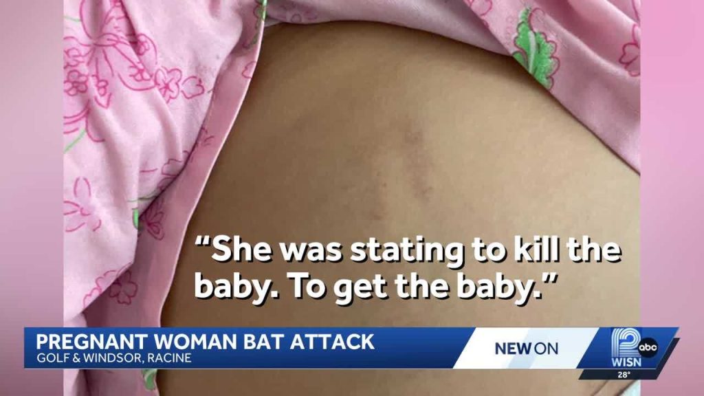 Pregnant woman ambushed, attacked with bat in Wisconsin: Reports