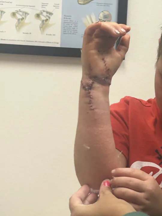 Parent files lawsuit against North Rock Creek Public Schools after severe playground injury