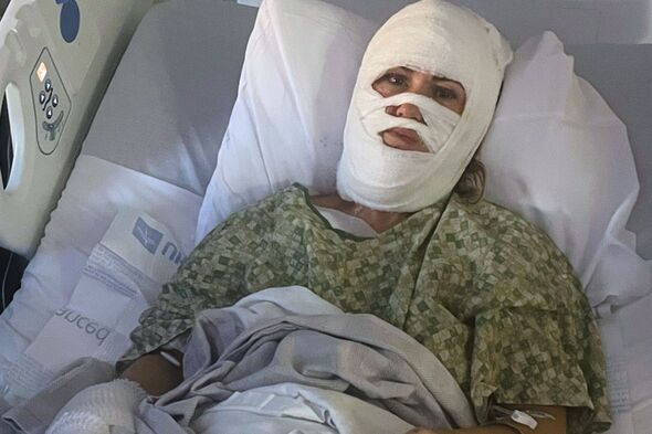 Georgia woman left disfigured in vicious acid attack faces millions in medical bills