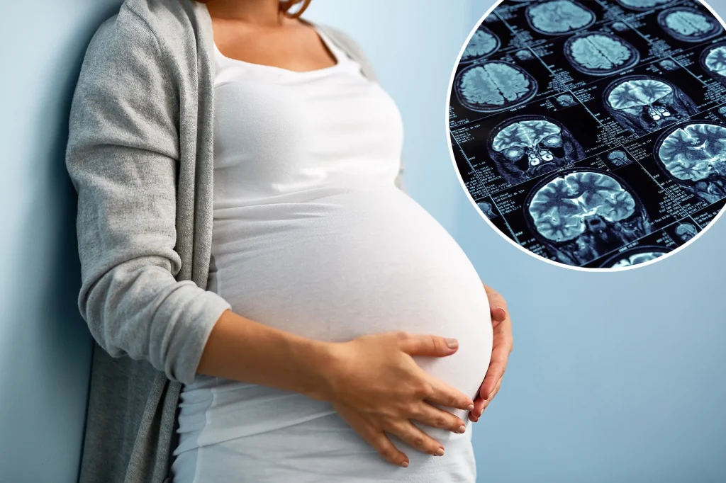 Study reveals: Pregnancy causes women to lose brain matter, but there's a silver lining