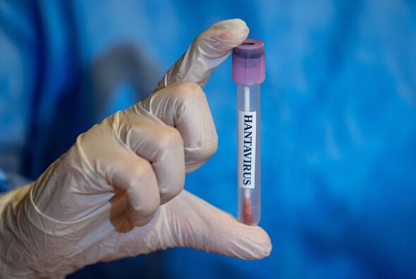 Terrifyingly Accurate Hantavirus Prediction Sparks Conspiracy Theories