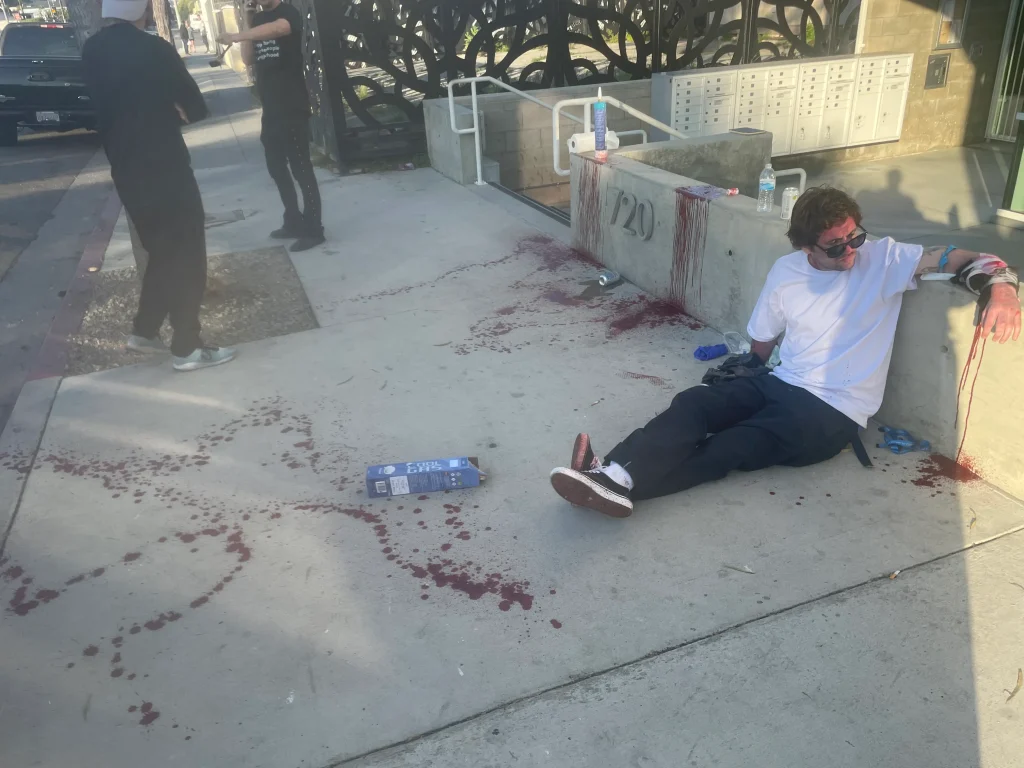 Samurai sword attacker who nearly hacked off man’s arm in Venice on the run