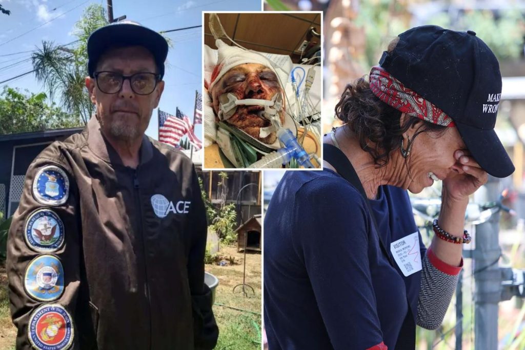 Wife of San Diego's 'Trump House' Victim Shares Grim Prognosis