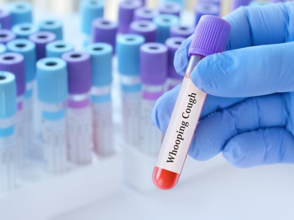 Pasadena School Faces Whooping Cough Outbreak Amid Rising Cases